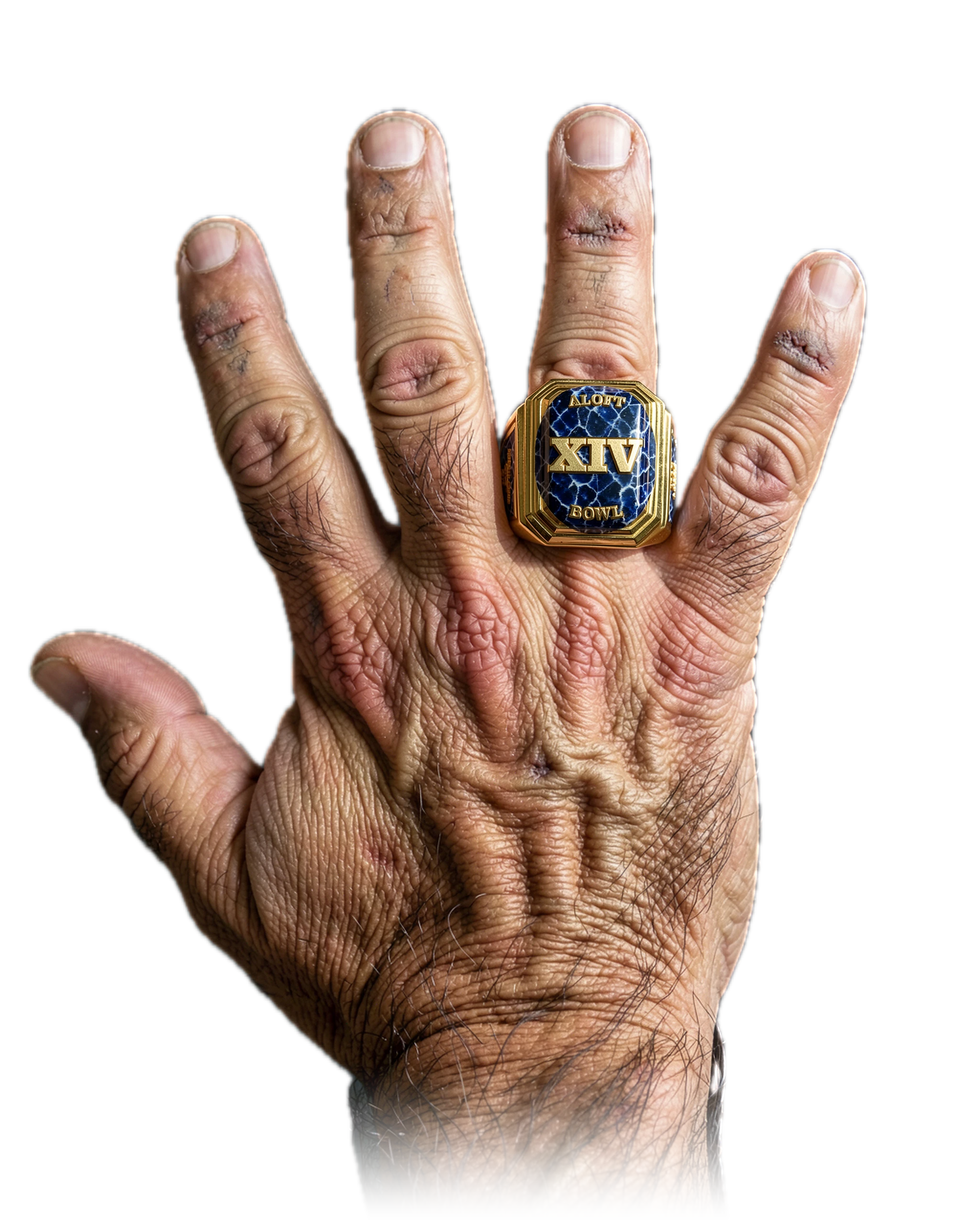 Ryan Ayers's 1 ALOFT Bowl championship rings, worn on one hand
